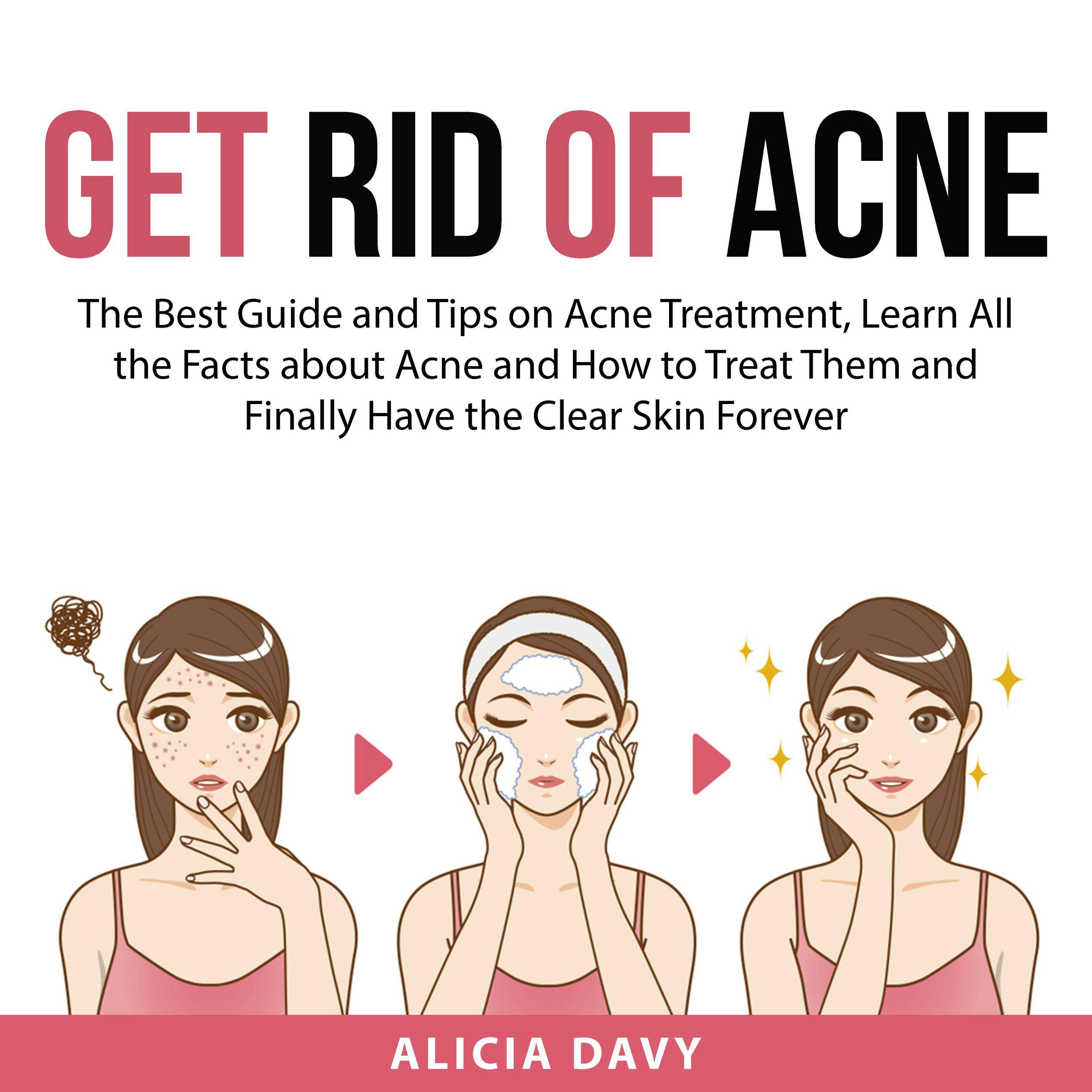 Get Rid of Acne: The Best Guide and Tips on Acne Treatment, Learn All the Facts about Acne and How to Treat Them and Finally Have the Clear Skin Forever - Alicia Davy