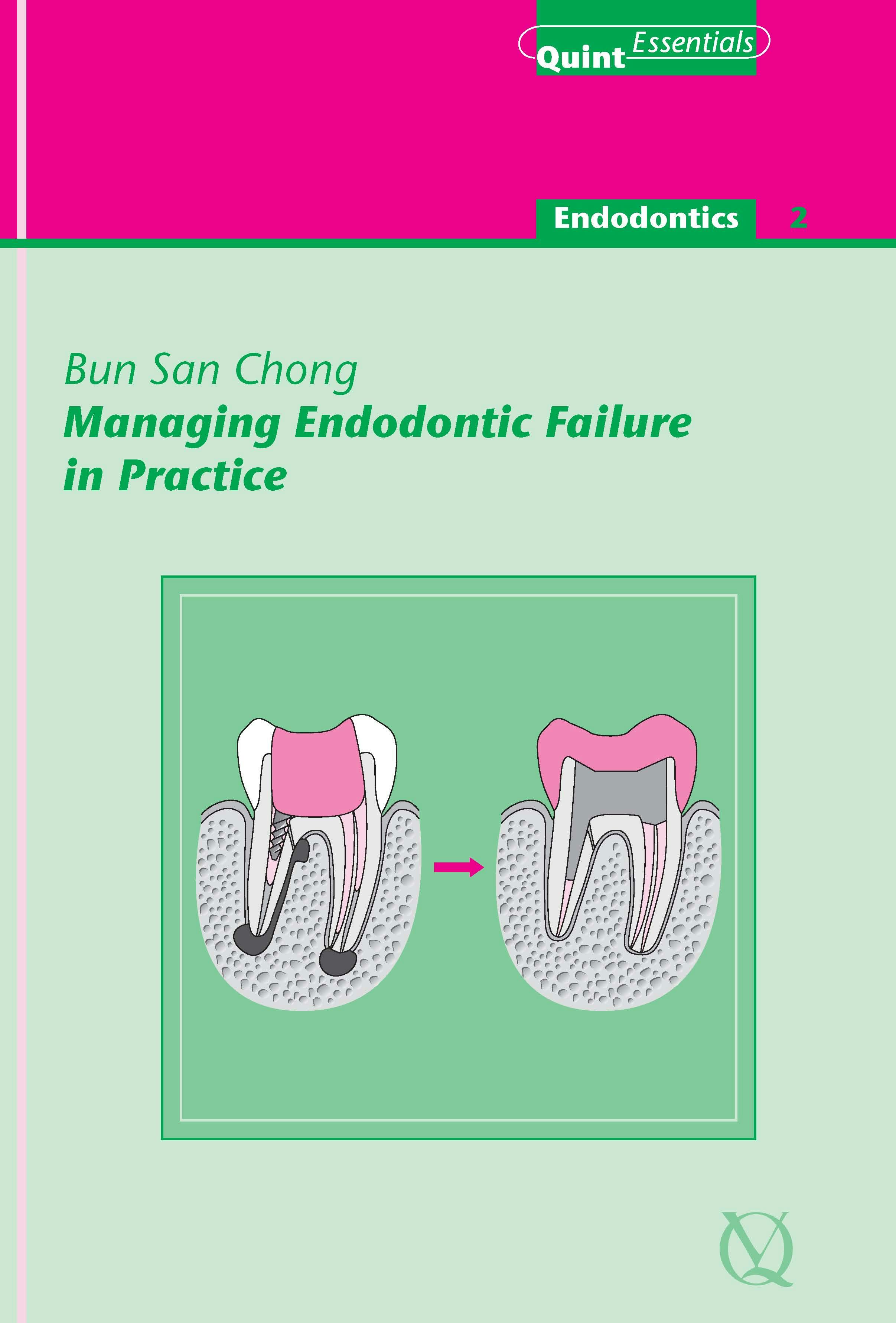 Managing Endodontic Failure in Practice - Bun San Chong